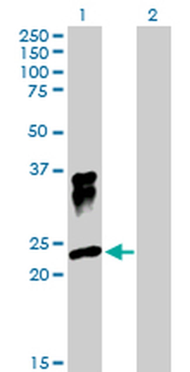 ORM1 Antibody in Western Blot (WB)