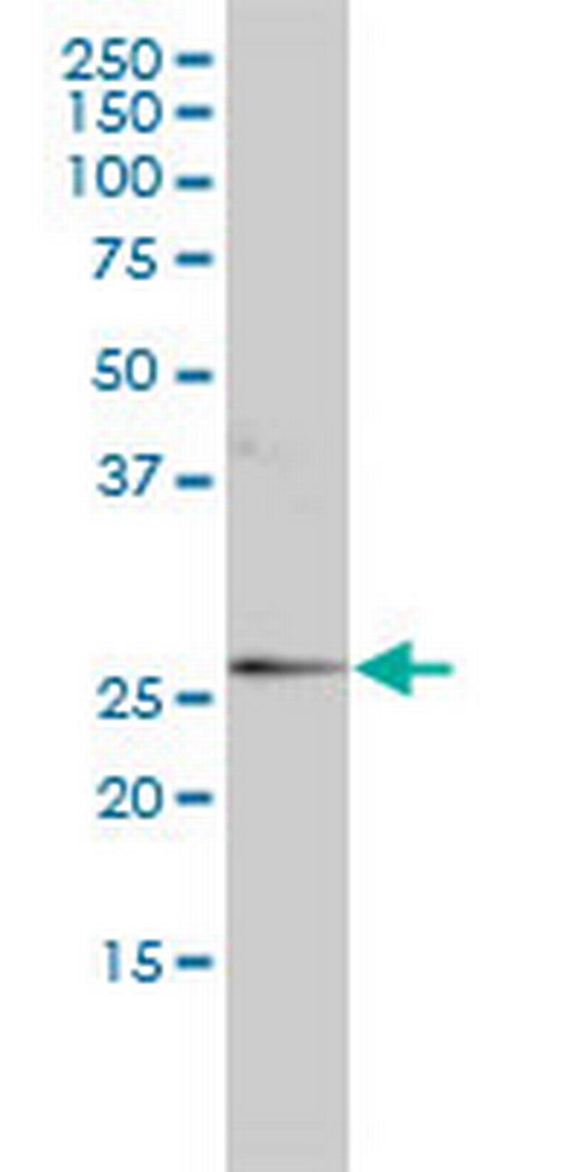 ORM1 Antibody in Western Blot (WB)