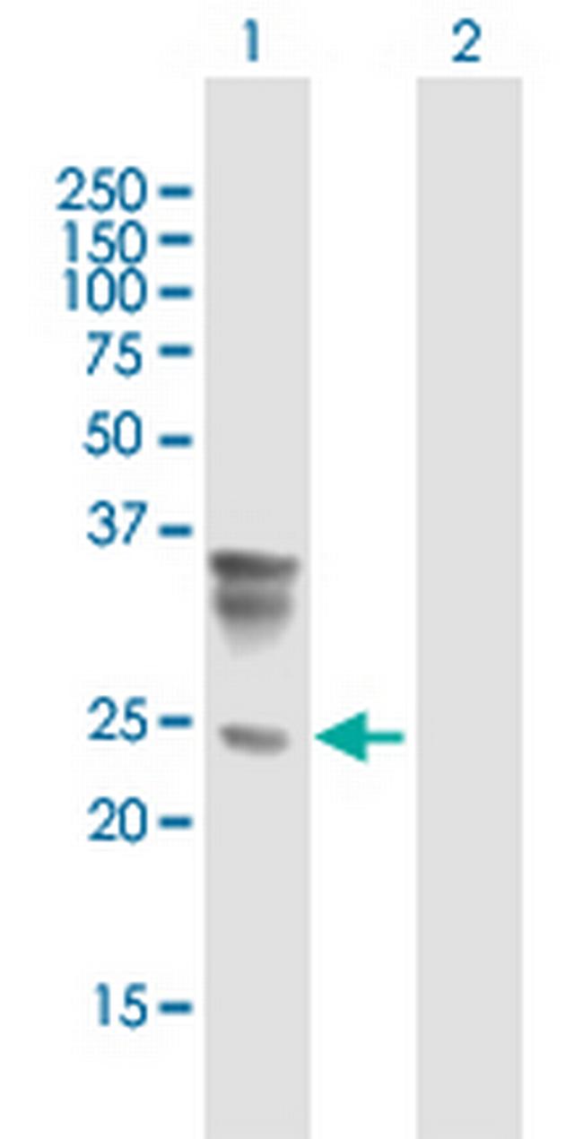 ORM2 Antibody in Western Blot (WB)