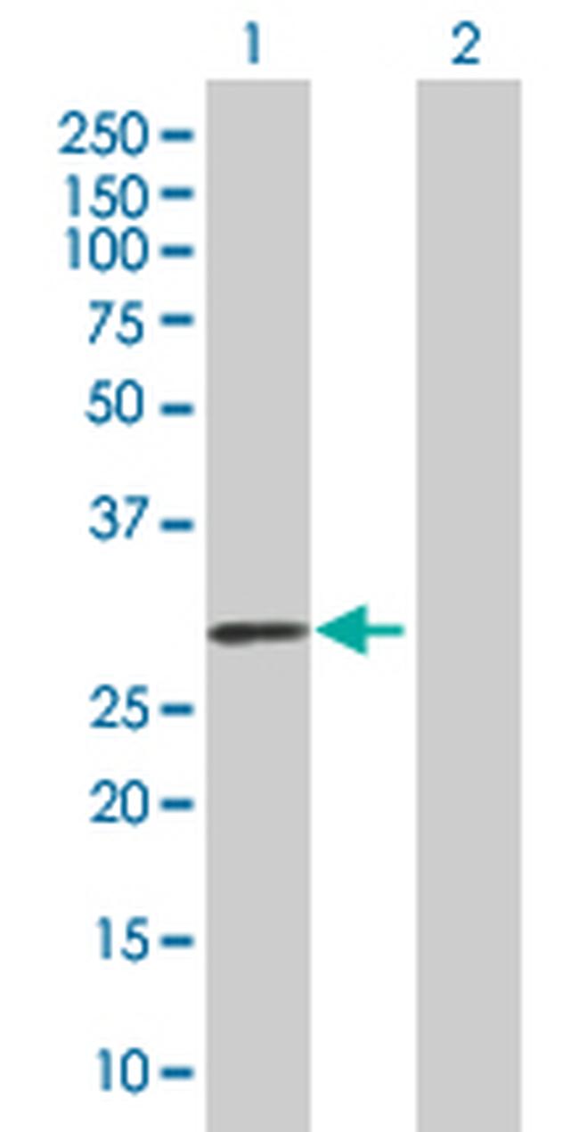 OSM Antibody in Western Blot (WB)