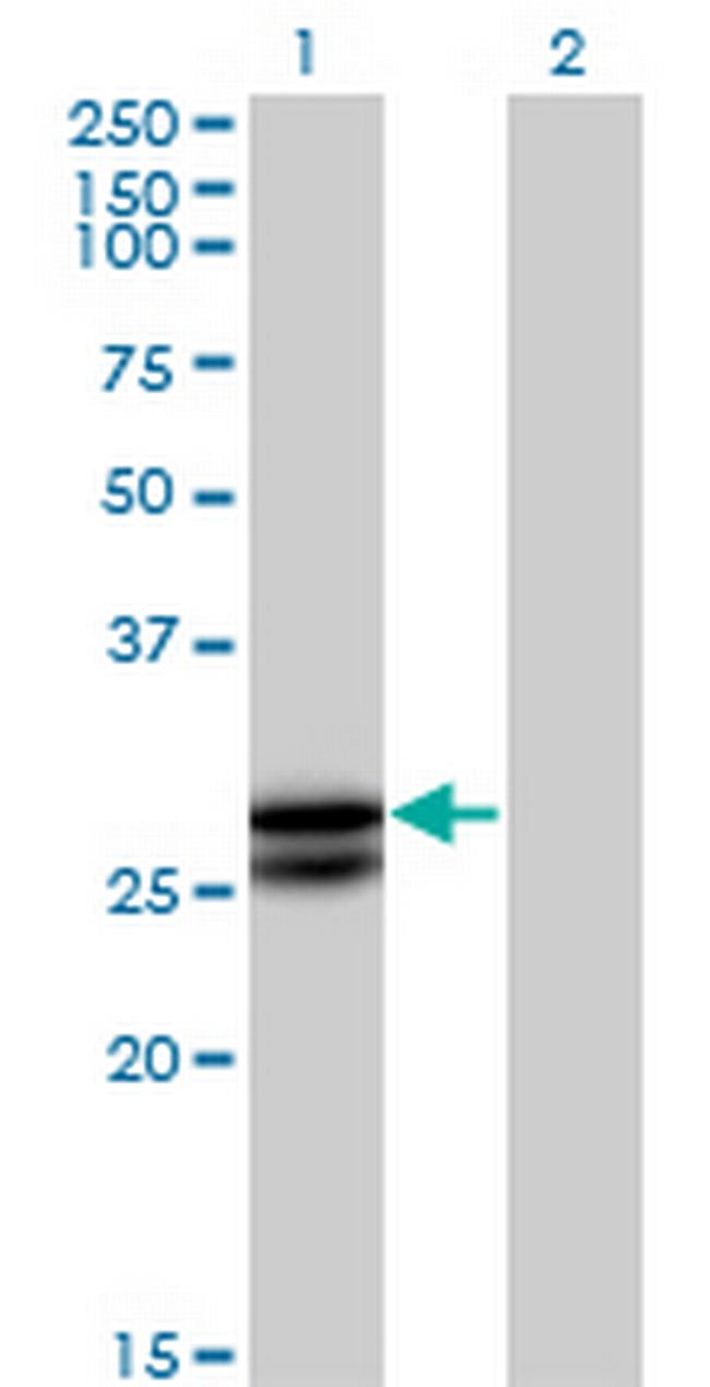 OSM Antibody in Western Blot (WB)