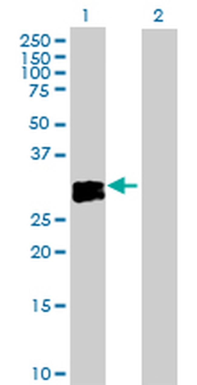 OSM Antibody in Western Blot (WB)