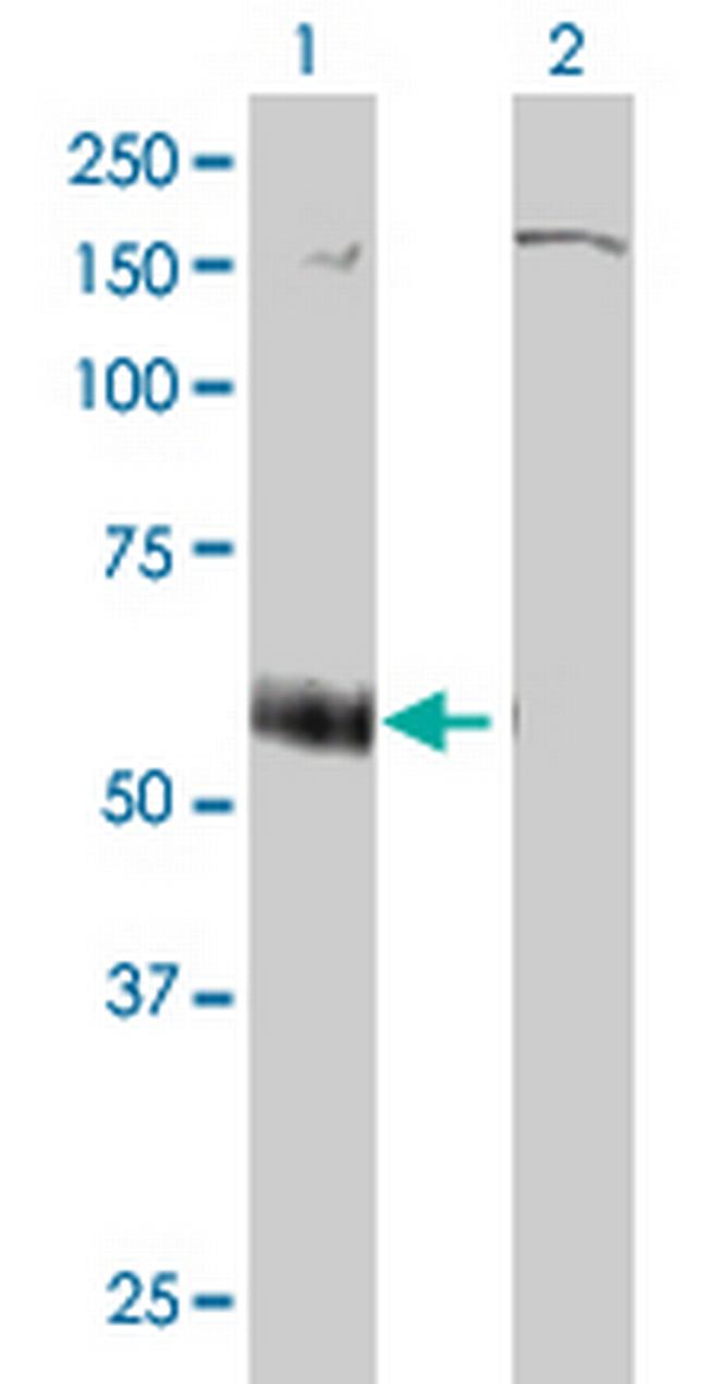 P2RX5 Antibody in Western Blot (WB)