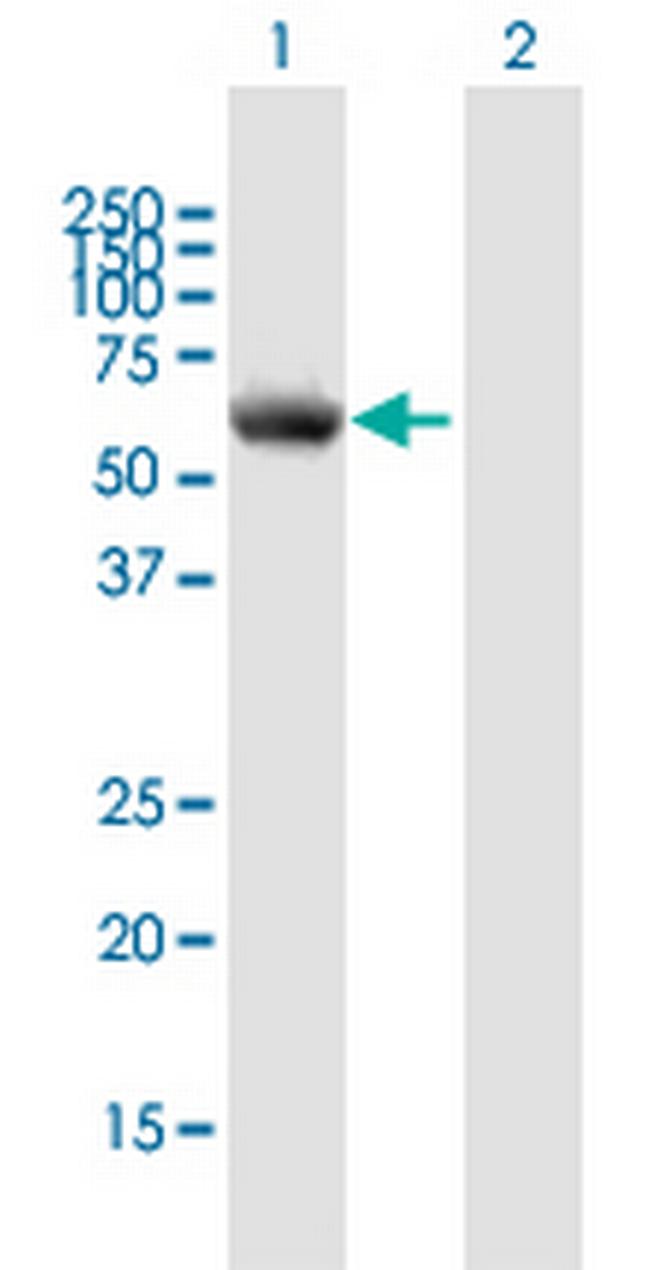 P4HA1 Antibody in Western Blot (WB)
