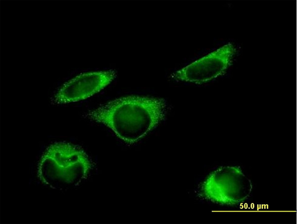 P4HB Antibody in Immunocytochemistry (ICC/IF)