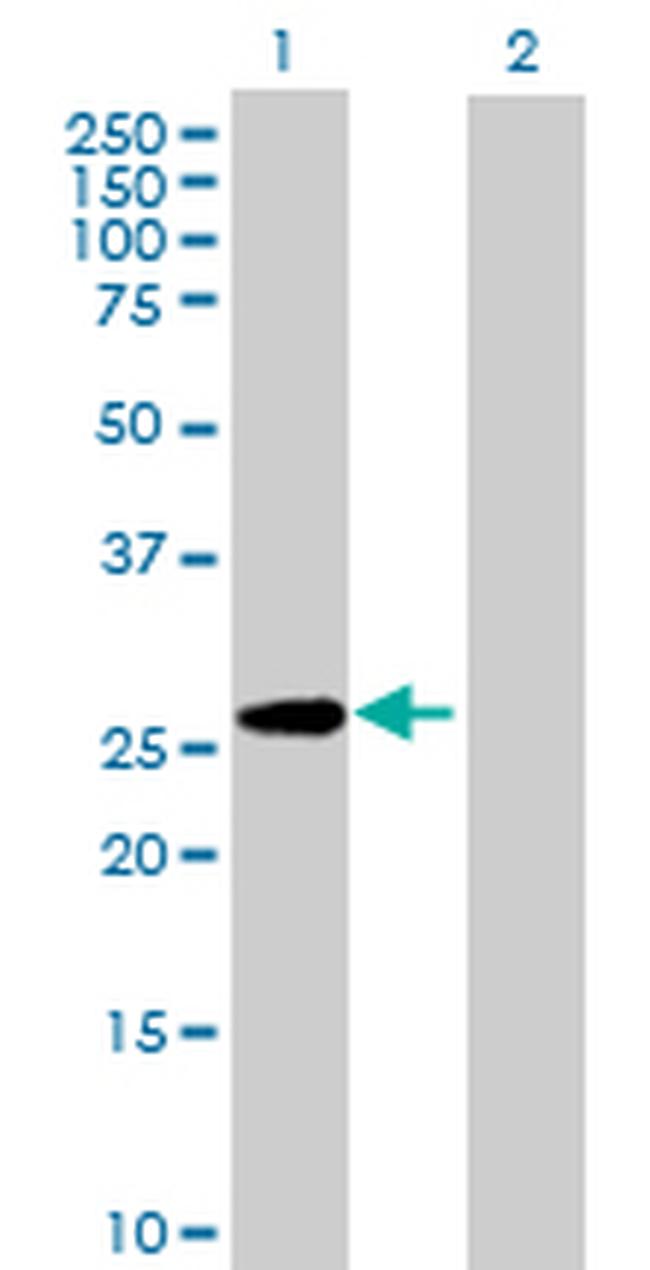 PAFAH1B3 Antibody in Western Blot (WB)