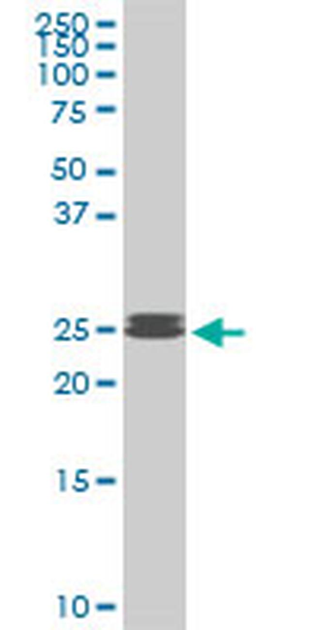 PAFAH1B3 Antibody in Western Blot (WB)