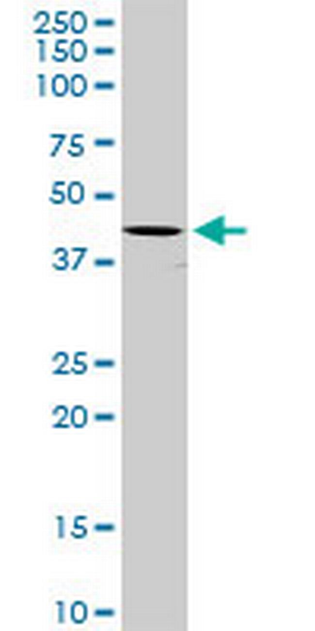 SERPINB2 Antibody in Western Blot (WB)