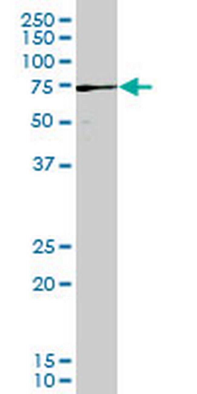 PAK3 Antibody in Western Blot (WB)