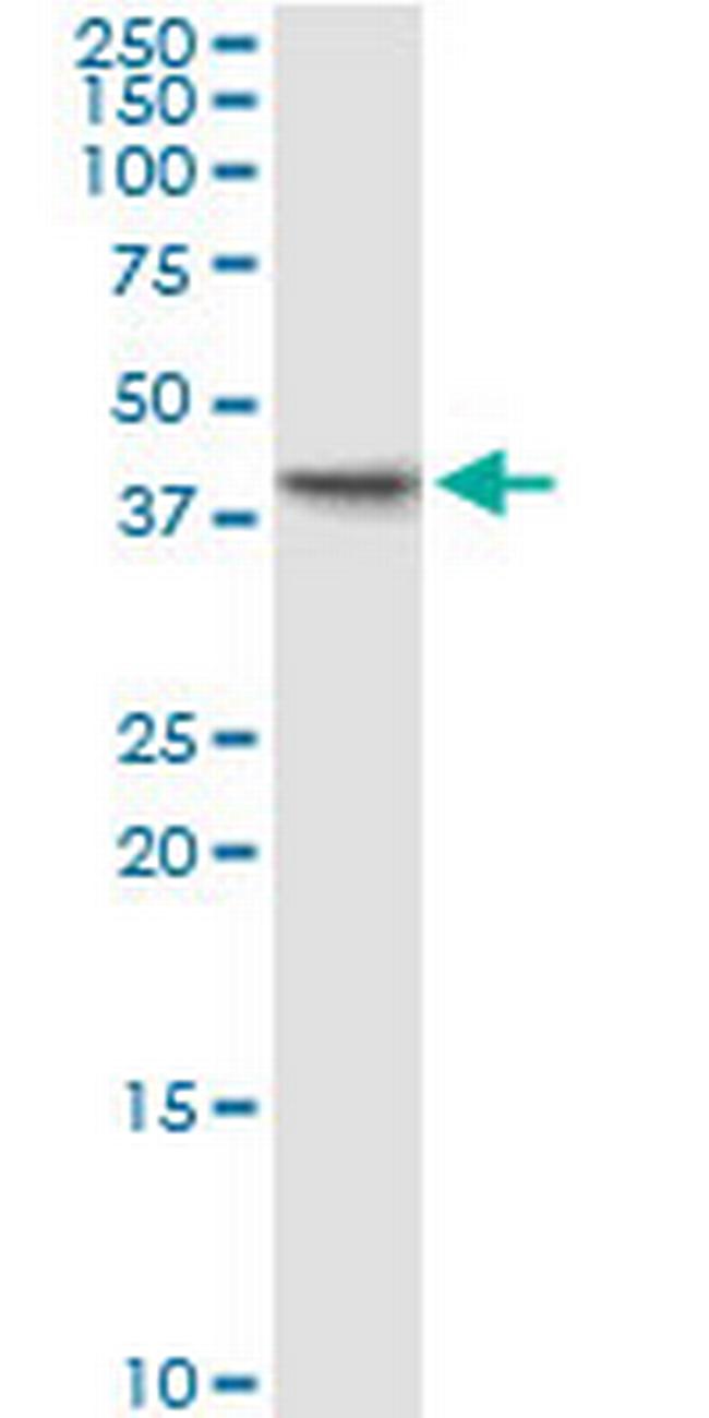 PDCL Antibody in Western Blot (WB)
