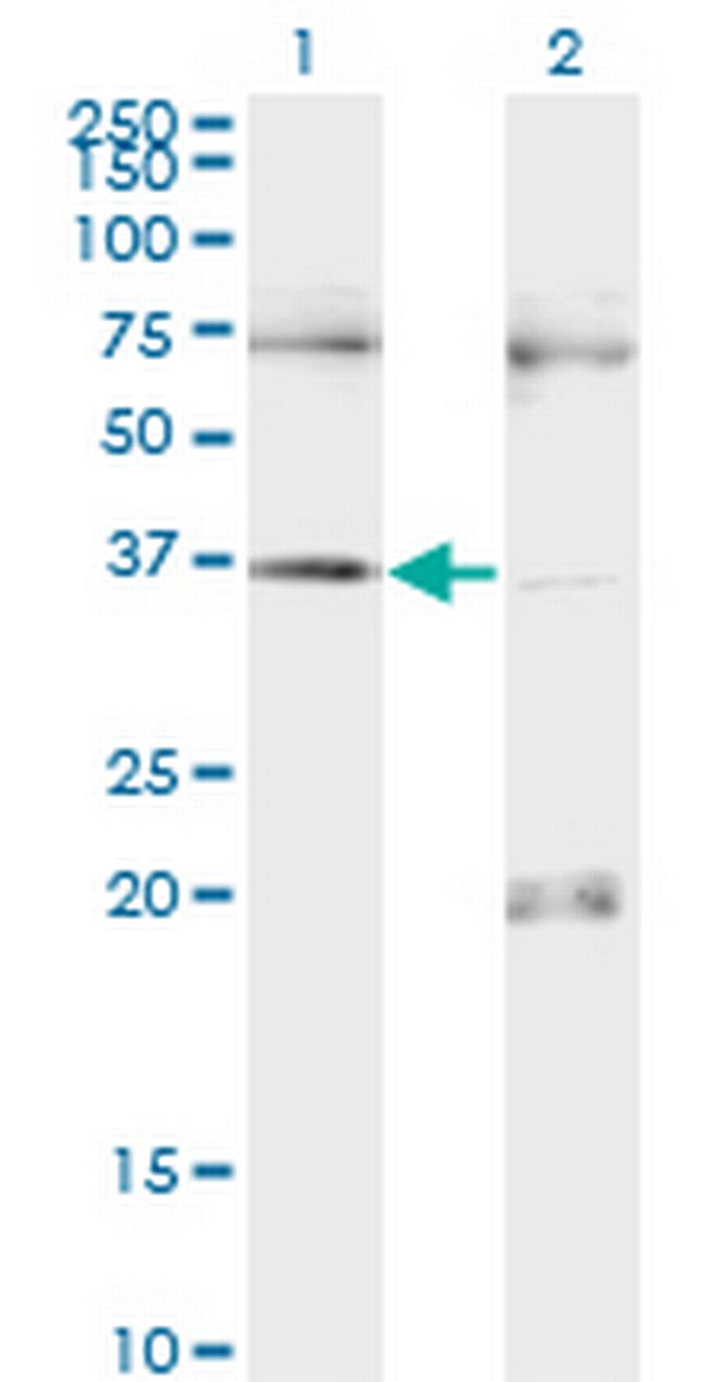 PAX9 Antibody in Western Blot (WB)