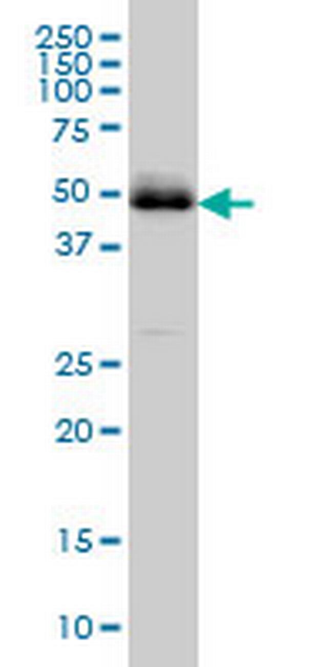 PBX2 Antibody in Western Blot (WB)