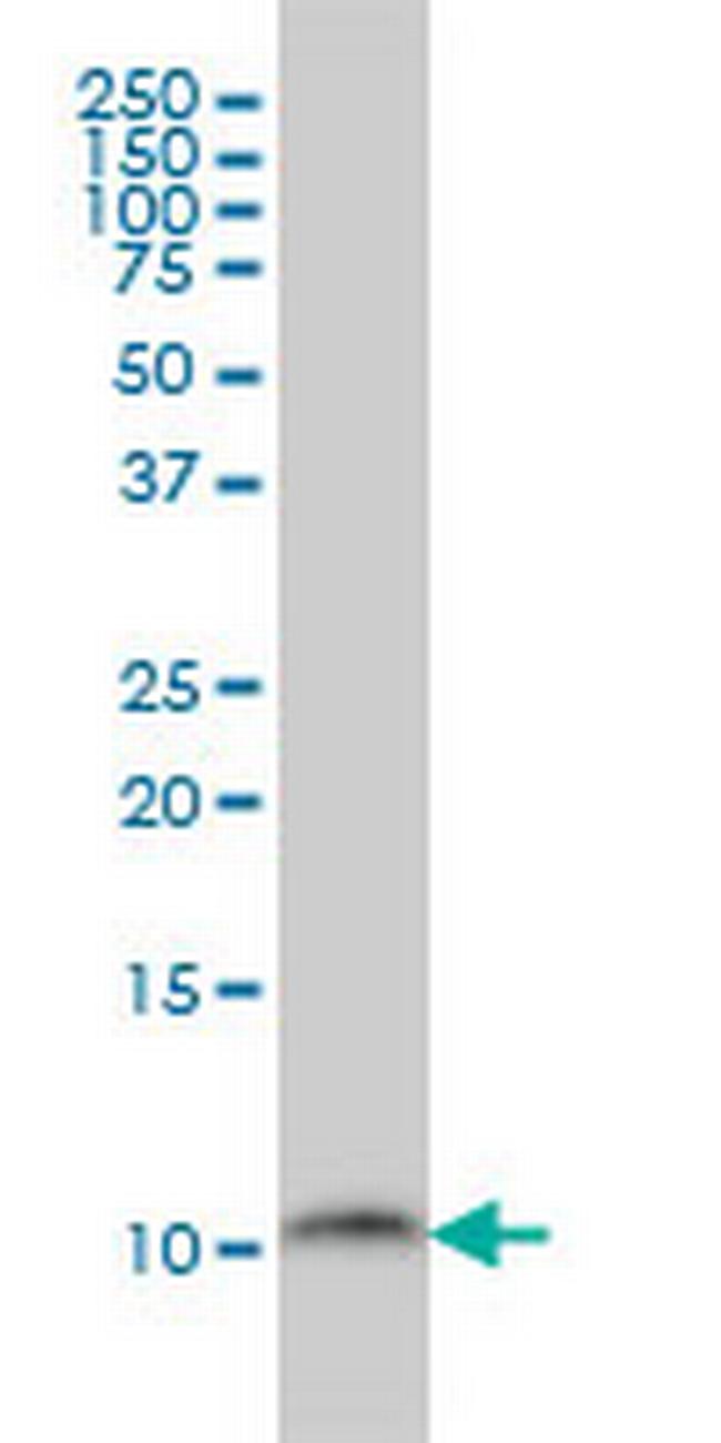 PCBD1 Antibody in Western Blot (WB)