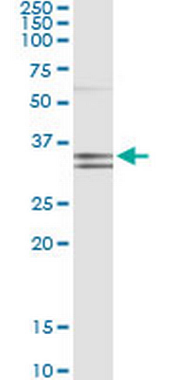 PCDH1 Antibody in Immunoprecipitation (IP)