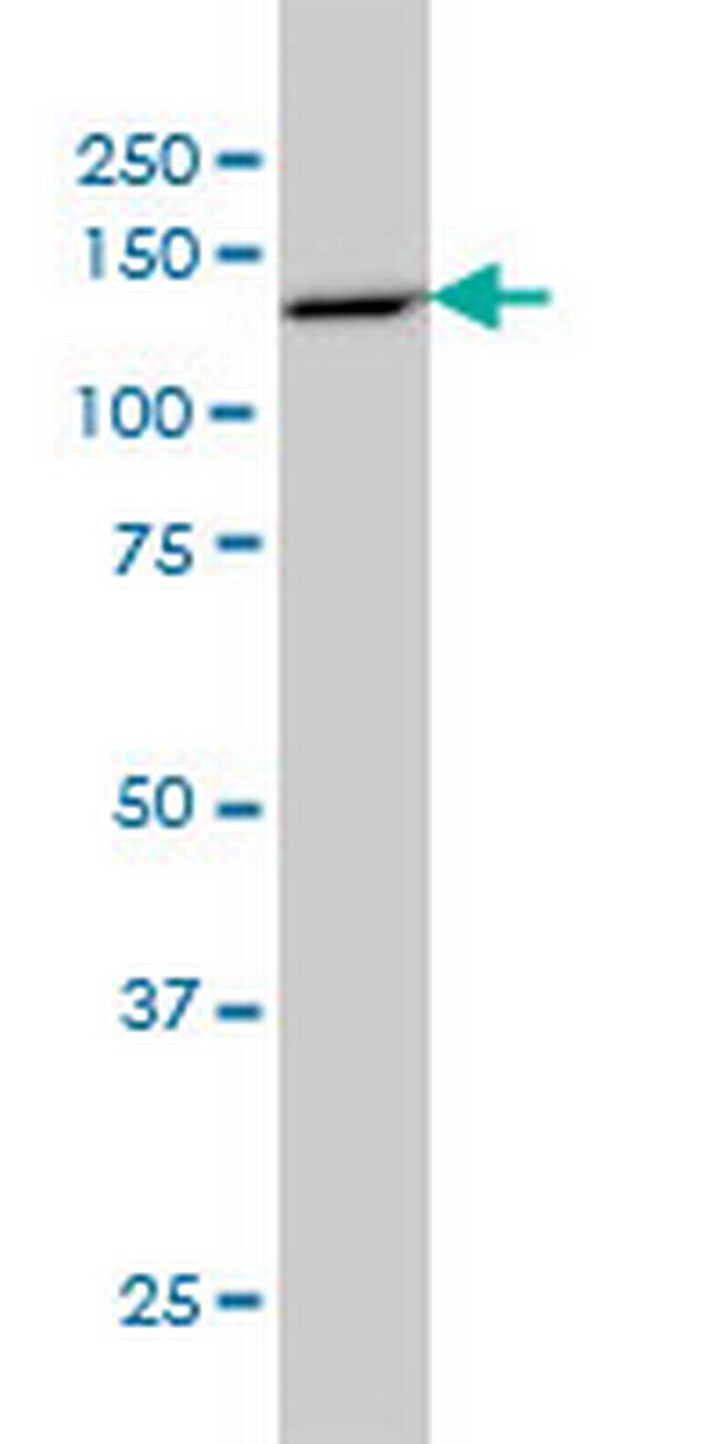 PCDH8 Antibody in Western Blot (WB)