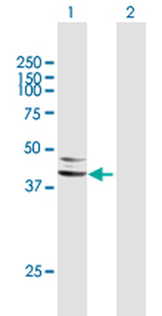 SERPINA5 Antibody in Western Blot (WB)