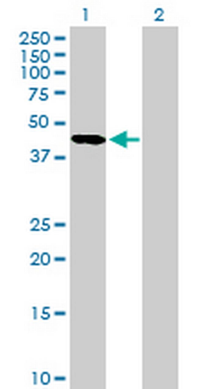 SERPINA5 Antibody in Western Blot (WB)