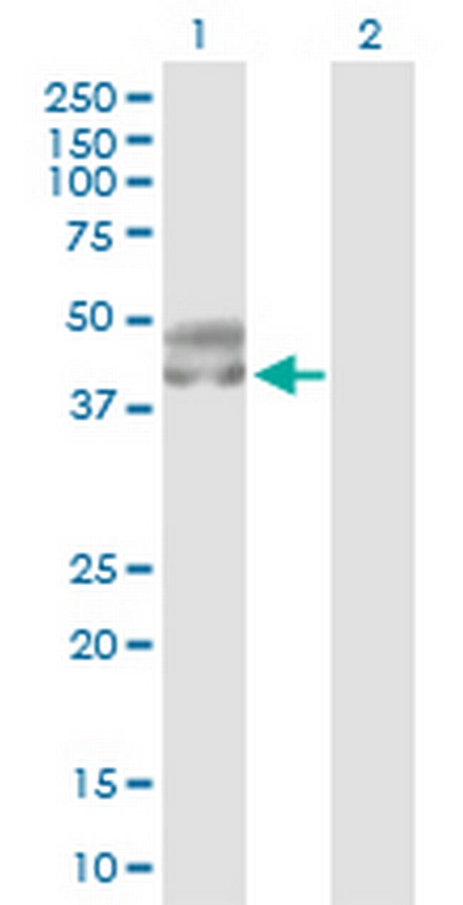 SERPINA5 Antibody in Western Blot (WB)