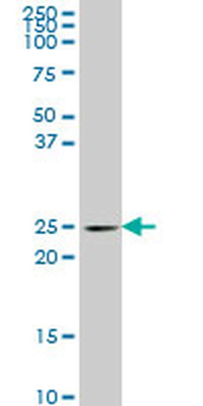 PCMT1 Antibody in Western Blot (WB)