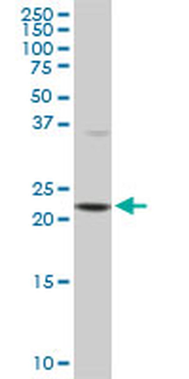 PCMT1 Antibody in Western Blot (WB)