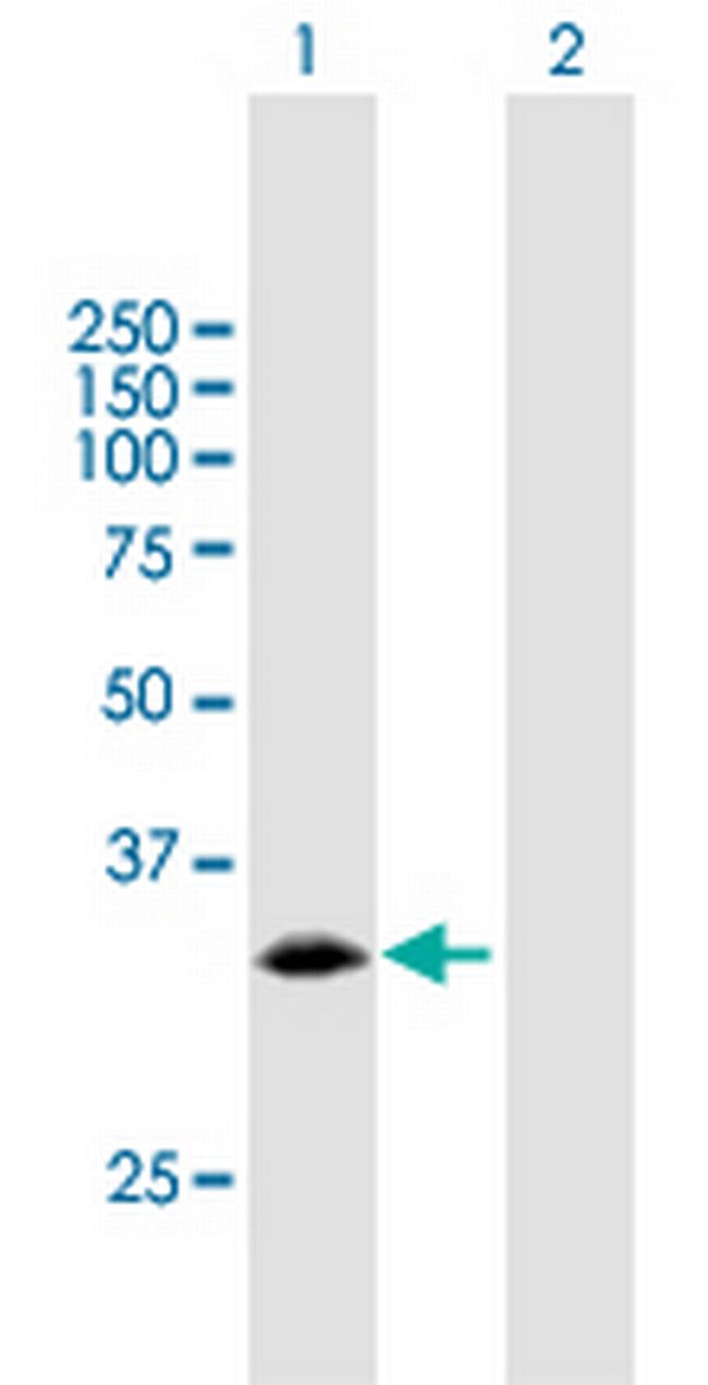 PCNA Antibody in Western Blot (WB)