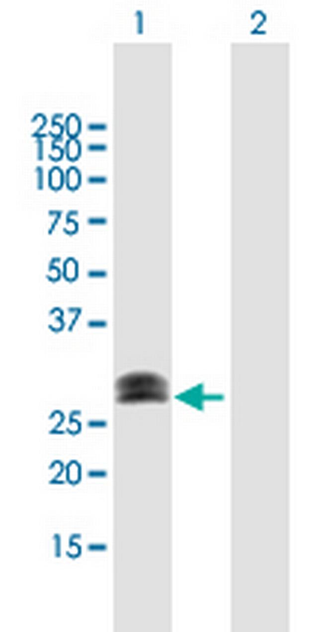 CHMP1A Antibody in Western Blot (WB)