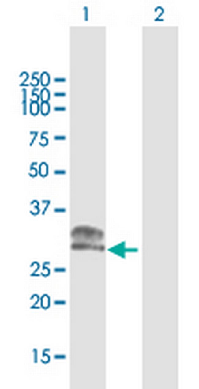 CHMP1A Antibody in Western Blot (WB)