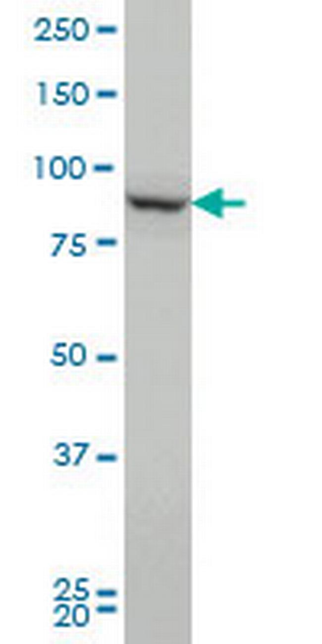 PCSK1 Antibody in Western Blot (WB)