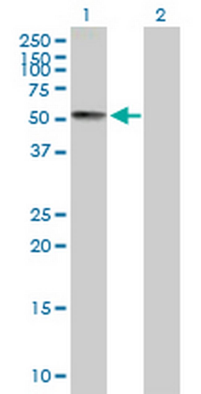 PCTK3 Antibody in Western Blot (WB)