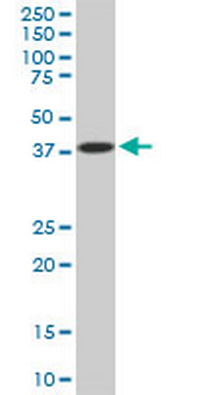 PCYT1A Antibody in Western Blot (WB)