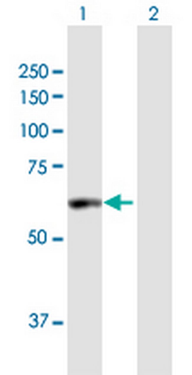 PDE1A Antibody in Western Blot (WB)