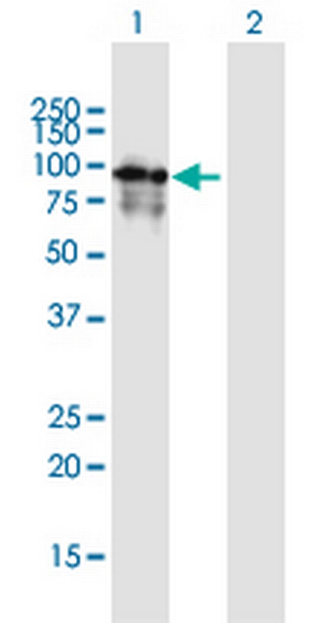 PDE4A Antibody in Western Blot (WB)