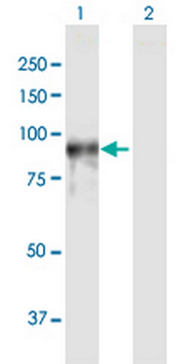 PDE4A Antibody in Western Blot (WB)
