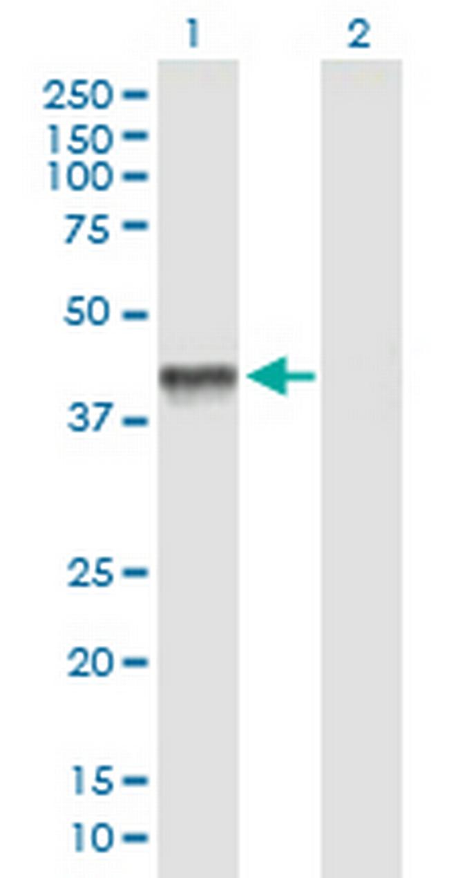 PDHA2 Antibody in Western Blot (WB)