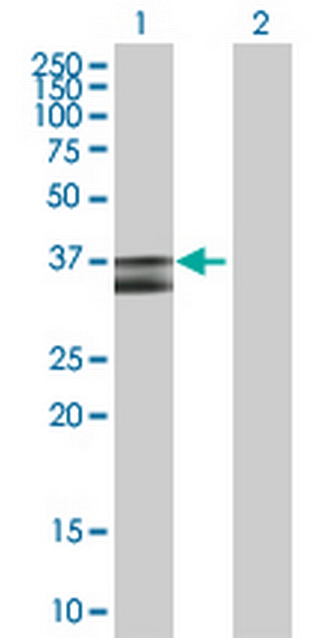 PDHB Antibody in Western Blot (WB)