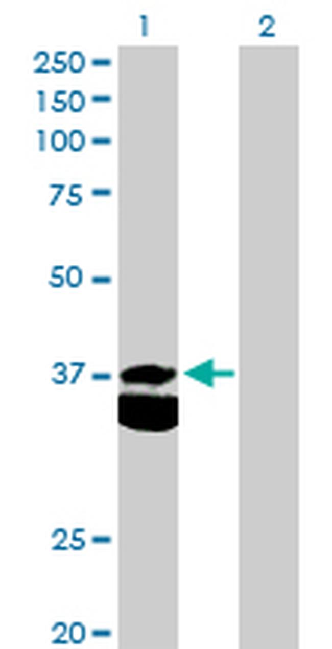 PDHB Antibody in Western Blot (WB)