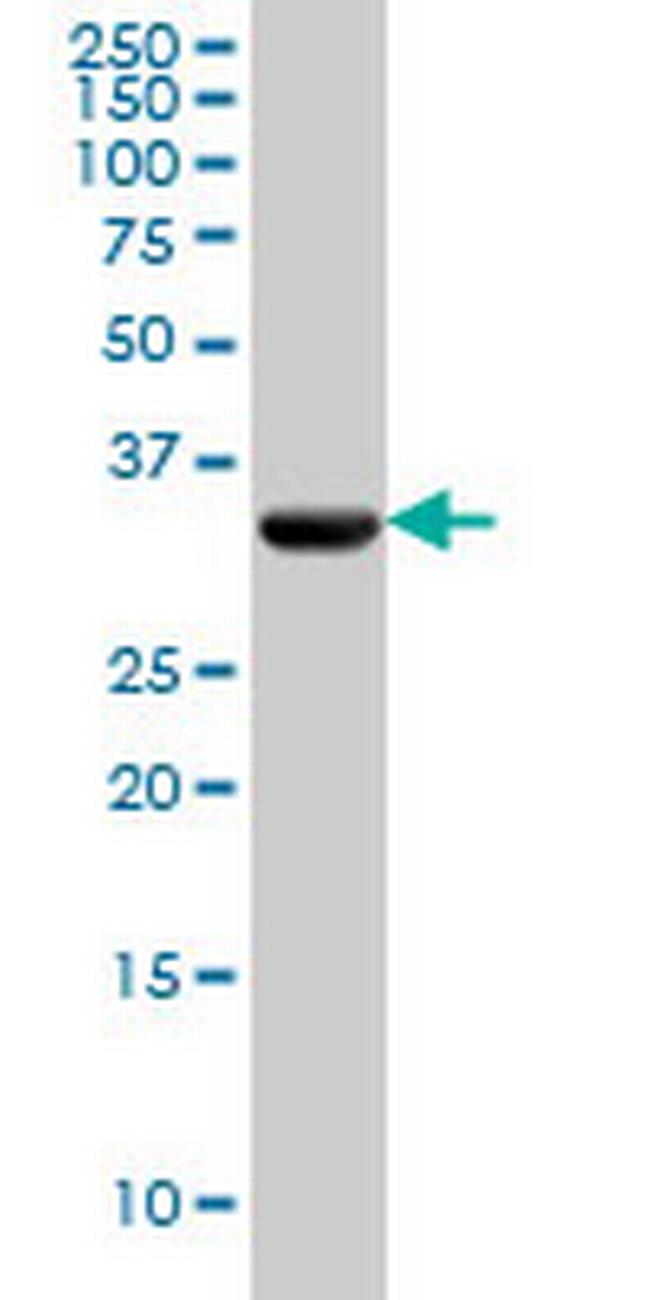 PDHB Antibody in Western Blot (WB)