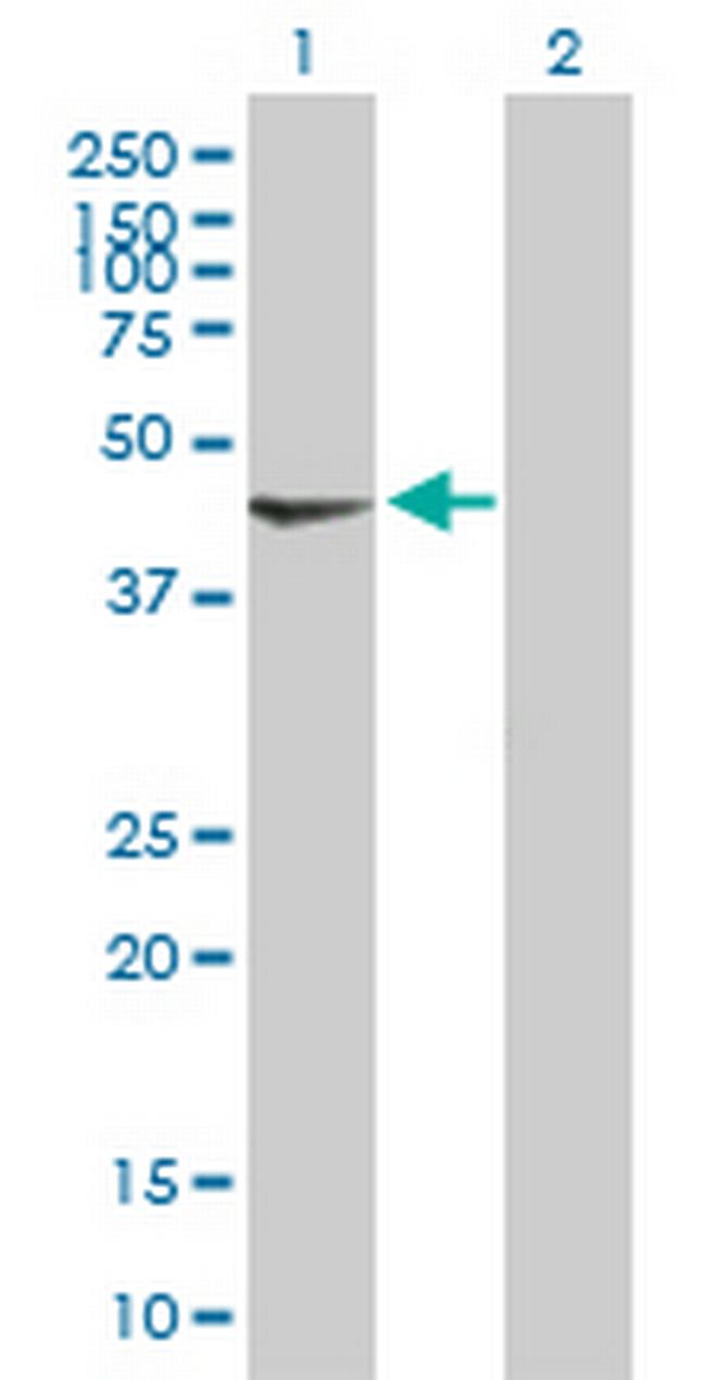 PDK2 Antibody in Western Blot (WB)