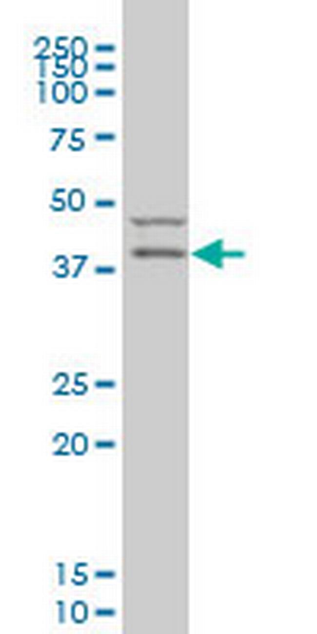 PDK2 Antibody in Western Blot (WB)