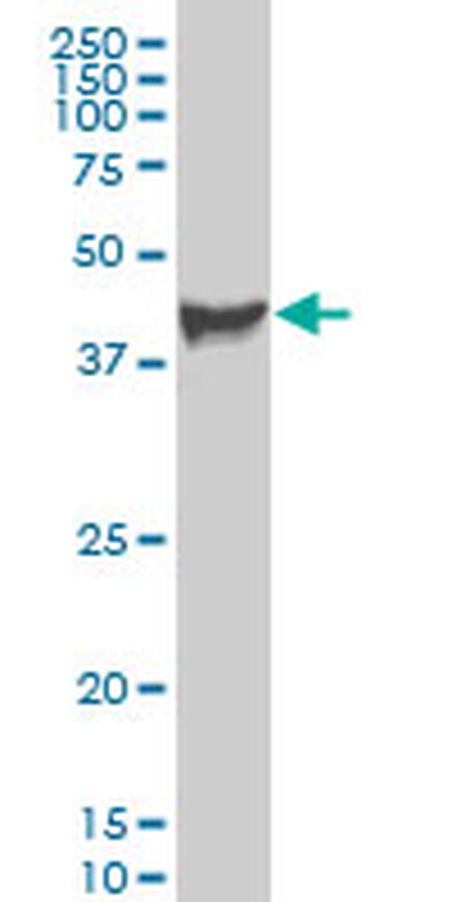 PDK3 Antibody in Western Blot (WB)