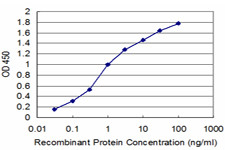 PDK4 Antibody in ELISA (ELISA)