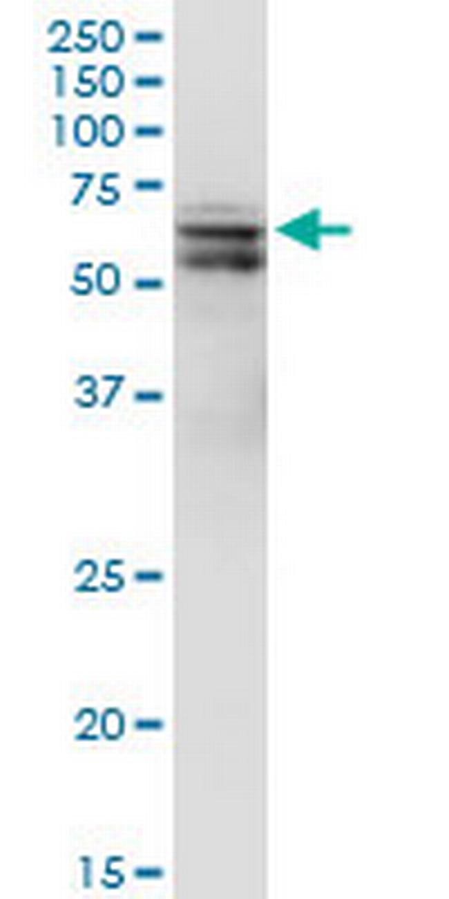 PDPK1 Antibody in Western Blot (WB)