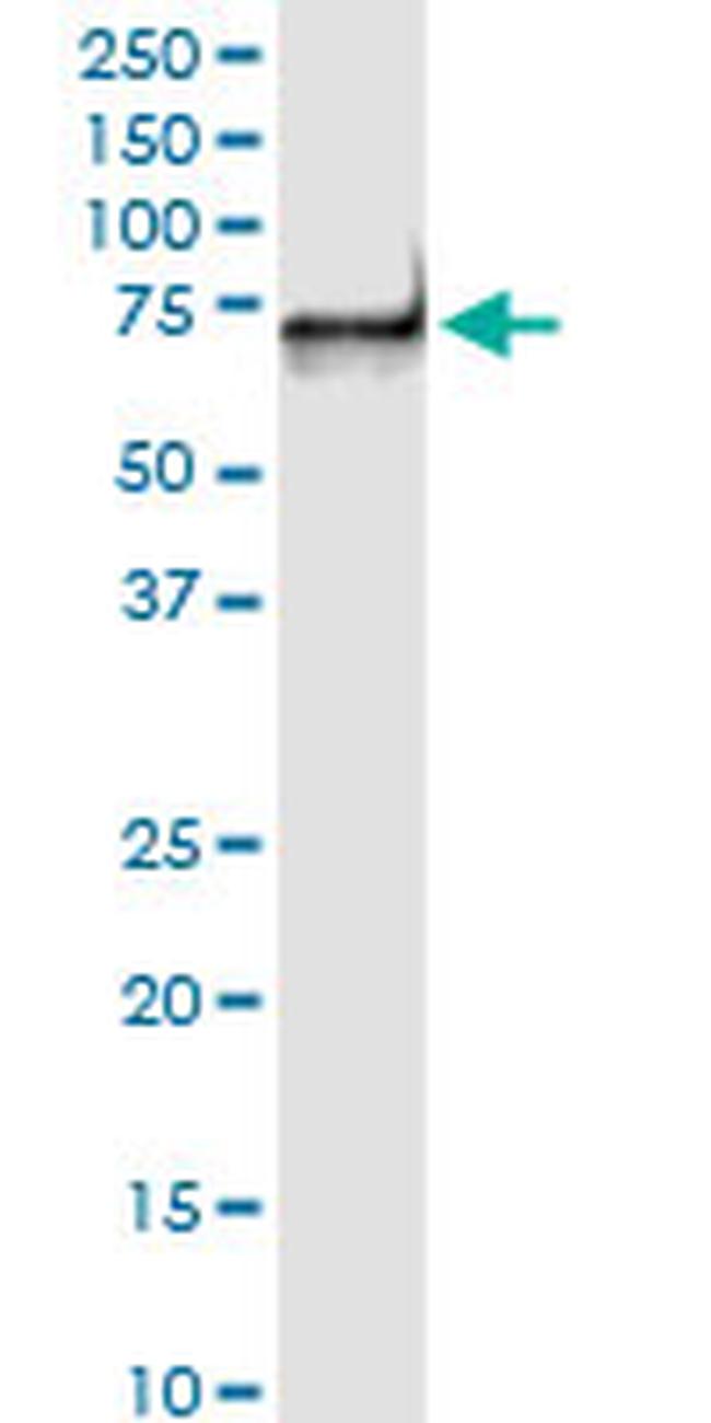 PDZK1 Antibody in Western Blot (WB)