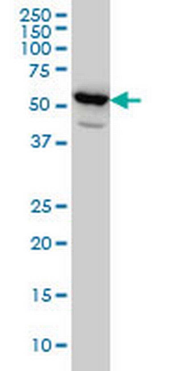 PET112L Antibody in Western Blot (WB)