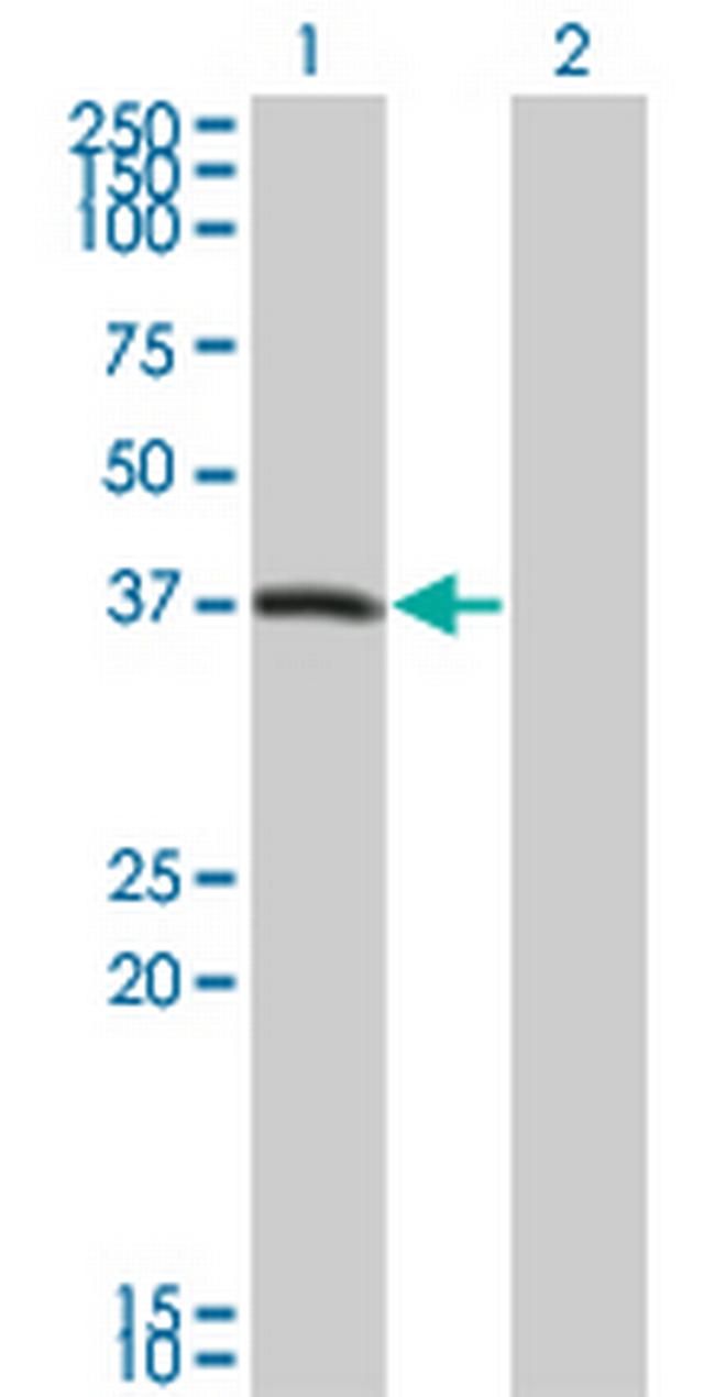 PEX10 Antibody in Western Blot (WB)