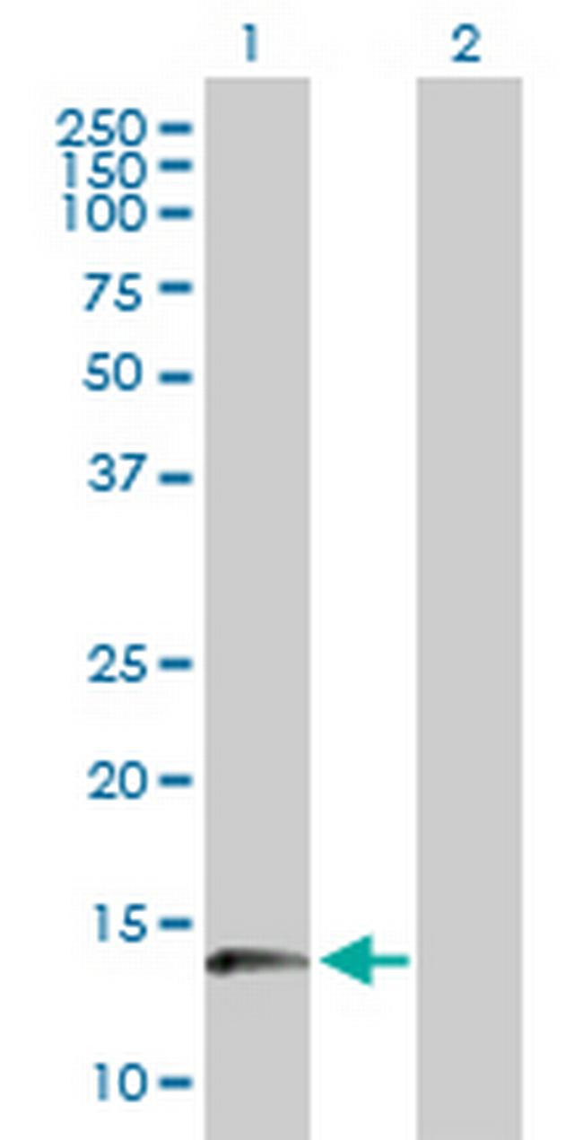 PFDN1 Antibody in Western Blot (WB)