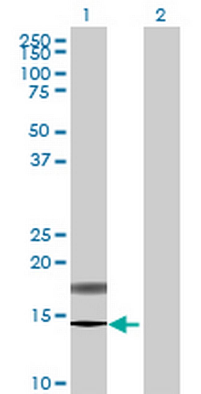 PFDN4 Antibody in Western Blot (WB)