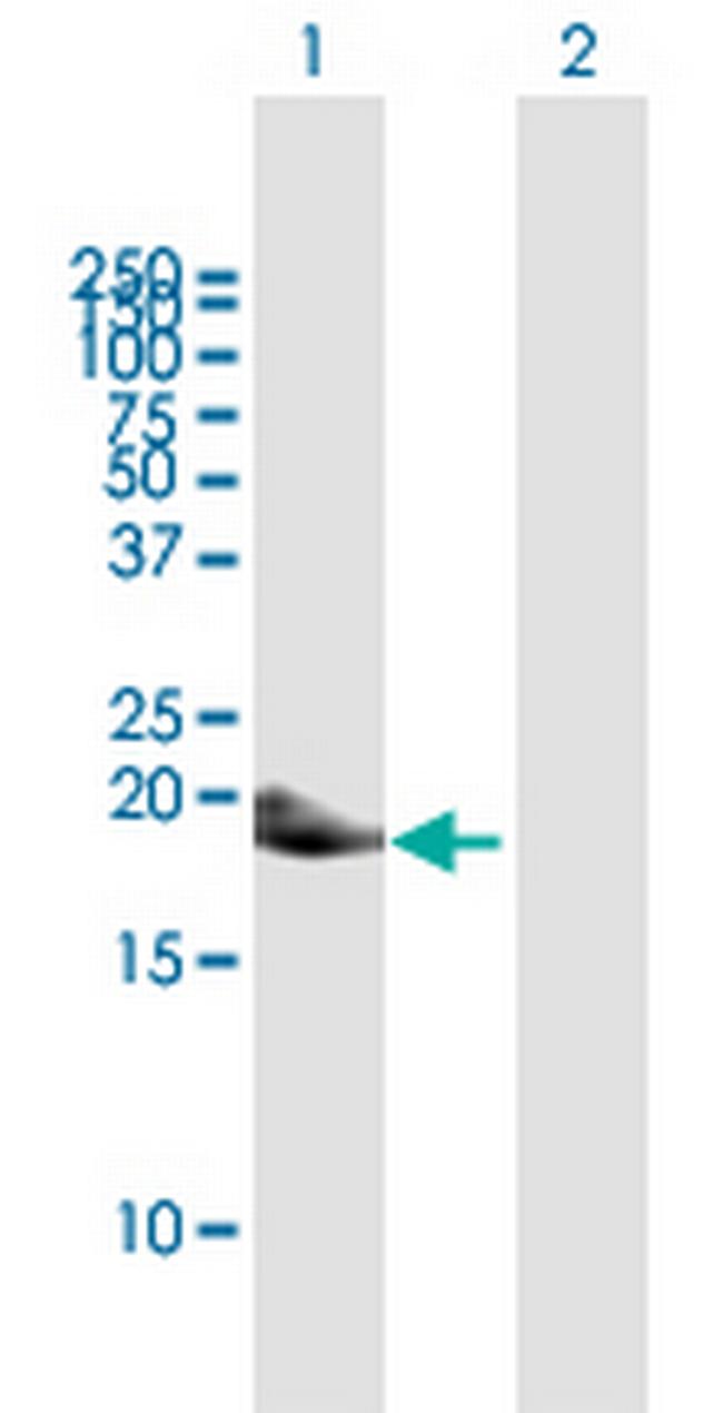PFDN4 Antibody in Western Blot (WB)