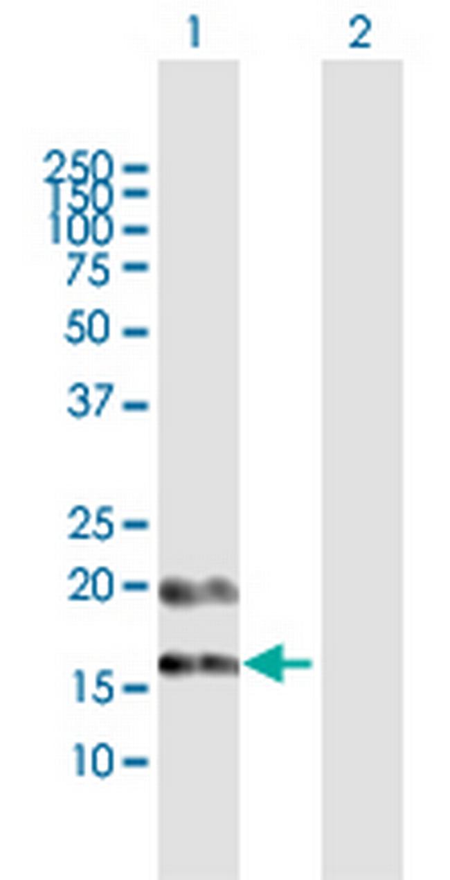 PFDN4 Antibody in Western Blot (WB)