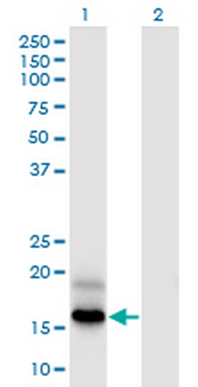 PFDN4 Antibody in Western Blot (WB)